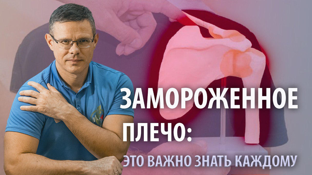 Замороженное плечо: Это важно знать каждому