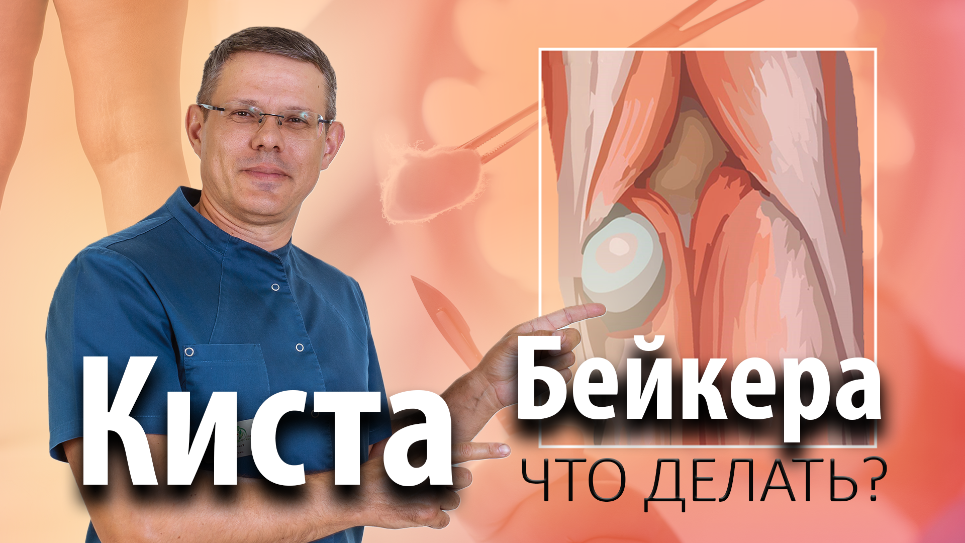 Киста Бейкера: Что делать?