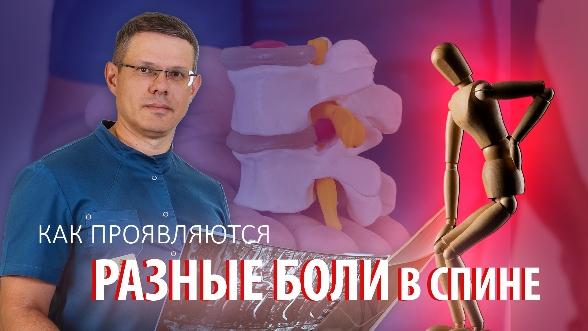 Как проявляются разные боли в спине?